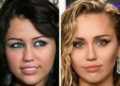 Before and After Fame