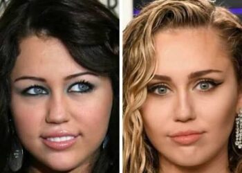 Before and After Fame