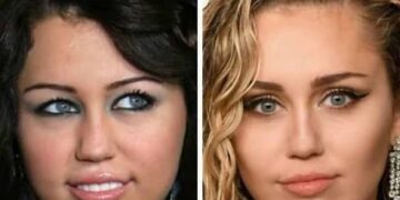 Before and After Fame