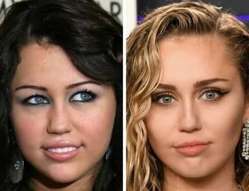 Before and After Fame